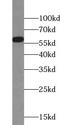 Tamm-Horsfall urinary glycoprotein antibody, FNab09294, FineTest, Western Blot image 
