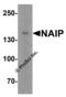 Baculoviral IAP repeat-containing protein 1 antibody, 3315, ProSci, Western Blot image 