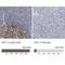 Histone Acetyltransferase 1 antibody, NBP1-87835, Novus Biologicals, Immunohistochemistry paraffin image 