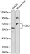 Carboxylesterase 2 antibody, GTX55569, GeneTex, Western Blot image 