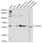 Epoxide hydrolase 2 antibody, A01999, Boster Biological Technology, Western Blot image 