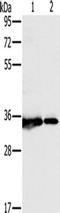 Complex I intermediate-associated protein 30, mitochondrial antibody, TA350207, Origene, Western Blot image 