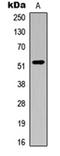 Bilirubin oxidase antibody, orb344253, Biorbyt, Western Blot image 