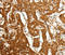 Cadherin Related 23 antibody, A02149-1, Boster Biological Technology, Immunohistochemistry paraffin image 