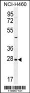Endothelin 3 antibody, 55-714, ProSci, Western Blot image 