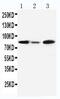 Minichromosome Maintenance Complex Component 5 antibody, PA5-79648, Invitrogen Antibodies, Western Blot image 