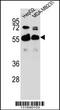 Rap1 GTPase-GDP Dissociation Stimulator 1 antibody, 56-132, ProSci, Western Blot image 