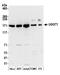UDP-Glucose Glycoprotein Glucosyltransferase 1 antibody, A305-530A, Bethyl Labs, Western Blot image 