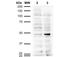 Acrolein antibody, NBP2-59359, Novus Biologicals, Western Blot image 