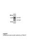F-Box Protein 7 antibody, ARP43128_P050, Aviva Systems Biology, Western Blot image 