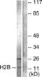 Histone H2B antibody, LS-C120509, Lifespan Biosciences, Western Blot image 