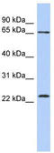 Zinc Finger Protein 428 antibody, TA329328, Origene, Western Blot image 