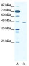 C-Terminal Binding Protein 1 antibody, TA330556, Origene, Western Blot image 
