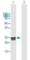 Dynein Axonemal Assembly Factor 5 antibody, H00054919-B01P, Novus Biologicals, Western Blot image 