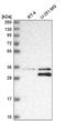S-methyl-5 -thioadenosine phosphorylase antibody, NBP2-56796, Novus Biologicals, Western Blot image 