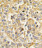 Atrial natriuretic peptide receptor 1 antibody, abx033880, Abbexa, Immunohistochemistry paraffin image 