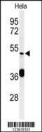DEAD-Box Helicase 49 antibody, 64-210, ProSci, Western Blot image 