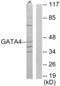 GATA Binding Protein 4 antibody, abx013491, Abbexa, Western Blot image 