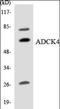 Uncharacterized aarF domain-containing protein kinase 4 antibody, orb197924, Biorbyt, Western Blot image 
