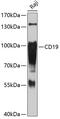 CD19 antibody, A00154-3, Boster Biological Technology, Western Blot image 