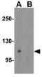 Glutamate Receptor Interacting Protein 1 antibody, GTX31521, GeneTex, Western Blot image 
