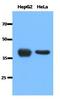 ACAT-1 antibody, GTX53681, GeneTex, Western Blot image 