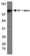 Hypoxia-inducible factor 1-alpha antibody, TA336766, Origene, Western Blot image 