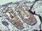 ADP Ribosylation Factor Like GTPase 5B antibody, M13605, Boster Biological Technology, Immunohistochemistry paraffin image 
