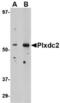Plexin domain-containing protein 2 antibody, TA306509, Origene, Western Blot image 