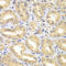 Engulfment and cell motility protein 3 antibody, LS-C349044, Lifespan Biosciences, Immunohistochemistry paraffin image 
