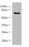 Zinc Finger Protein 133 antibody, A61926-100, Epigentek, Western Blot image 