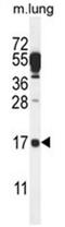 D-Aminoacyl-TRNA Deacylase 2 antibody, AP50463PU-N, Origene, Western Blot image 