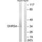 Dehydrogenase/reductase SDR family member 4 antibody, PA5-50020, Invitrogen Antibodies, Western Blot image 