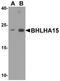 Class A basic helix-loop-helix protein 15 antibody, TA355021, Origene, Western Blot image 