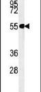 Rubicon Like Autophagy Enhancer antibody, PA5-25786, Invitrogen Antibodies, Western Blot image 