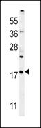 Vesicle Associated Membrane Protein 4 antibody, 62-077, ProSci, Western Blot image 