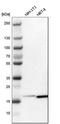 Actin Related Protein 2/3 Complex Subunit 3 antibody, HPA006550, Atlas Antibodies, Western Blot image 