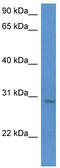UTP23 Small Subunit Processome Component antibody, TA342973, Origene, Western Blot image 
