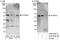 Regulator Of Microtubule Dynamics 3 antibody, A302-829A, Bethyl Labs, Immunoprecipitation image 