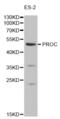 Protein C, Inactivator Of Coagulation Factors Va And VIIIa antibody, abx001236, Abbexa, Western Blot image 