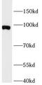 FOXO3A antibody, FNab10245, FineTest, Western Blot image 