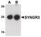 Synaptogyrin 3 antibody, PA5-20878, Invitrogen Antibodies, Western Blot image 