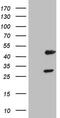 Nuclear Receptor Subfamily 1 Group I Member 3 antibody, MA5-26723, Invitrogen Antibodies, Western Blot image 