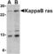 NFKB Inhibitor Interacting Ras Like 1 antibody, TA306083, Origene, Western Blot image 