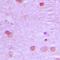 EGFR antibody, orb213878, Biorbyt, Immunohistochemistry paraffin image 