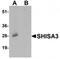 Shisa Family Member 3 antibody, TA320118, Origene, Western Blot image 
