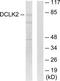 Doublecortin Like Kinase 2 antibody, TA313225, Origene, Western Blot image 