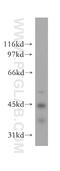 Elongator Acetyltransferase Complex Subunit 4 antibody, 12746-1-AP, Proteintech Group, Western Blot image 