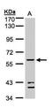 Aldehyde dehydrogenase X, mitochondrial antibody, PA5-28554, Invitrogen Antibodies, Western Blot image 