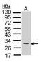Fibroblast growth factor 10 antibody, PA5-27300, Invitrogen Antibodies, Western Blot image 